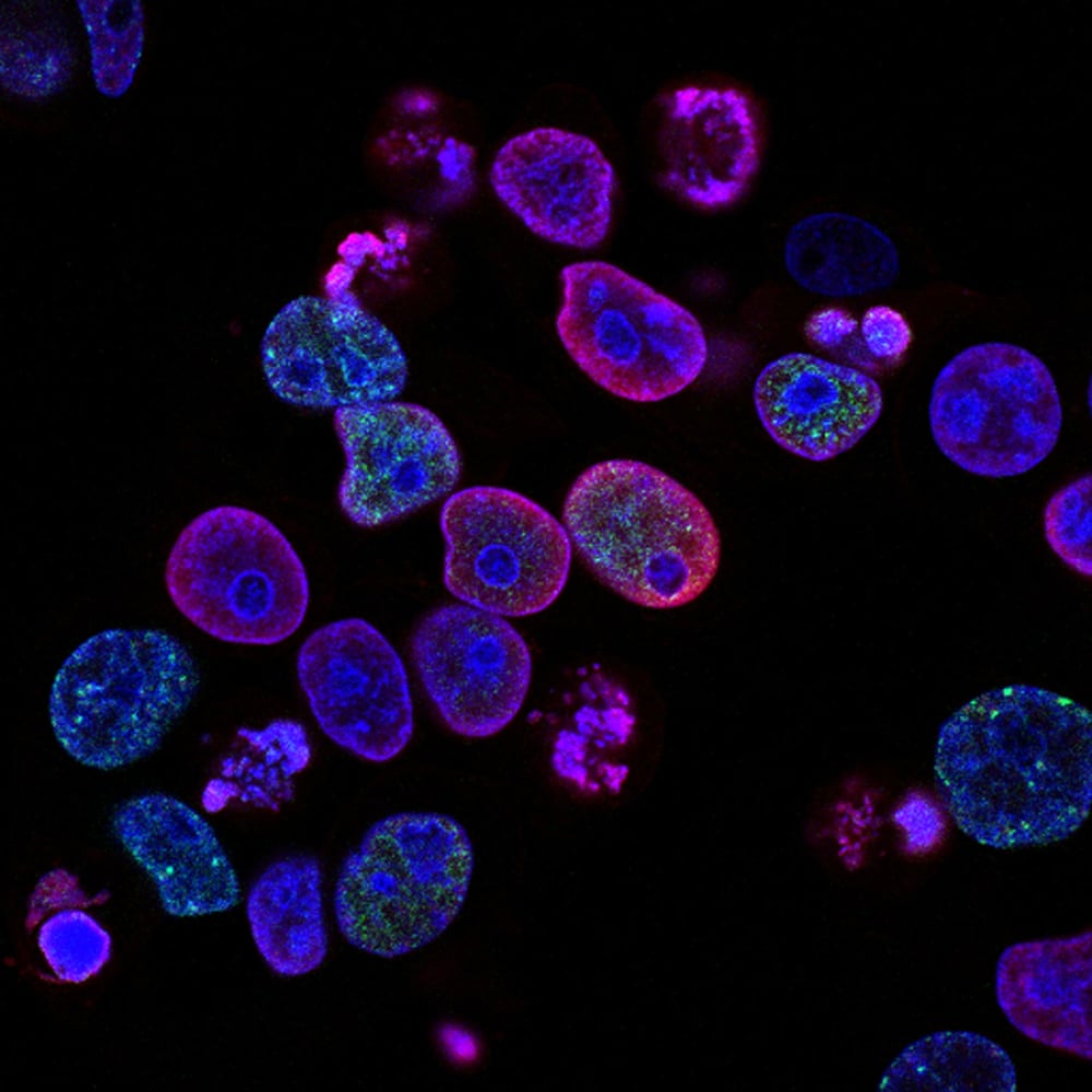 Biotech Arovella to receive Europe patent for its iNKT cell therapy platform
