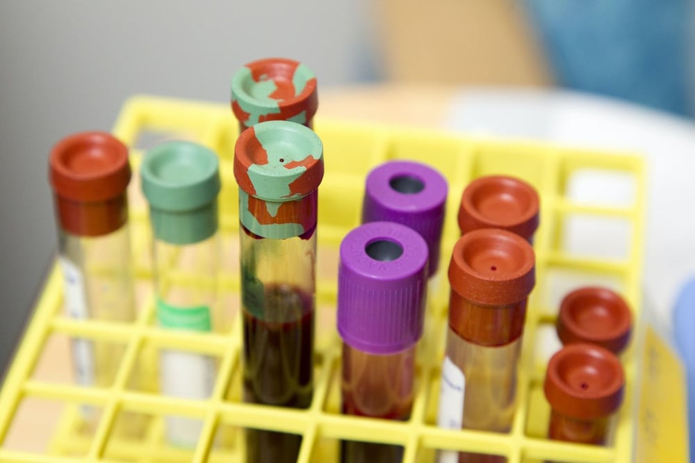 ‘Long Covid’ could be detected by a blood test. Antisense is filing patents on how to do it 