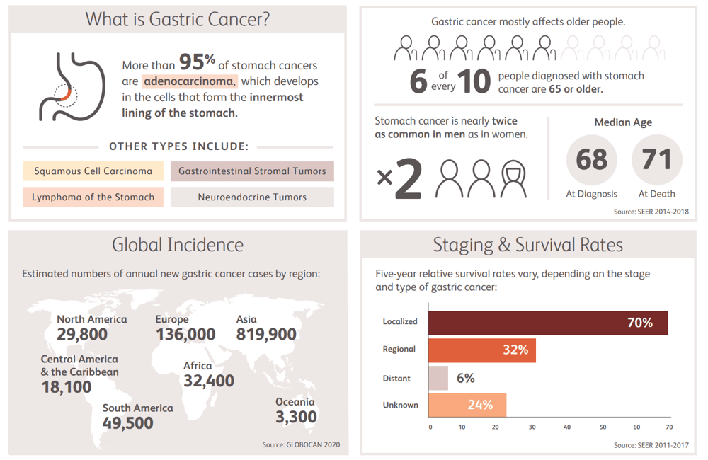 An infographic on gastric cancer, which Imugene's latest trial specifically targeted (Bristol Myers Squibb)