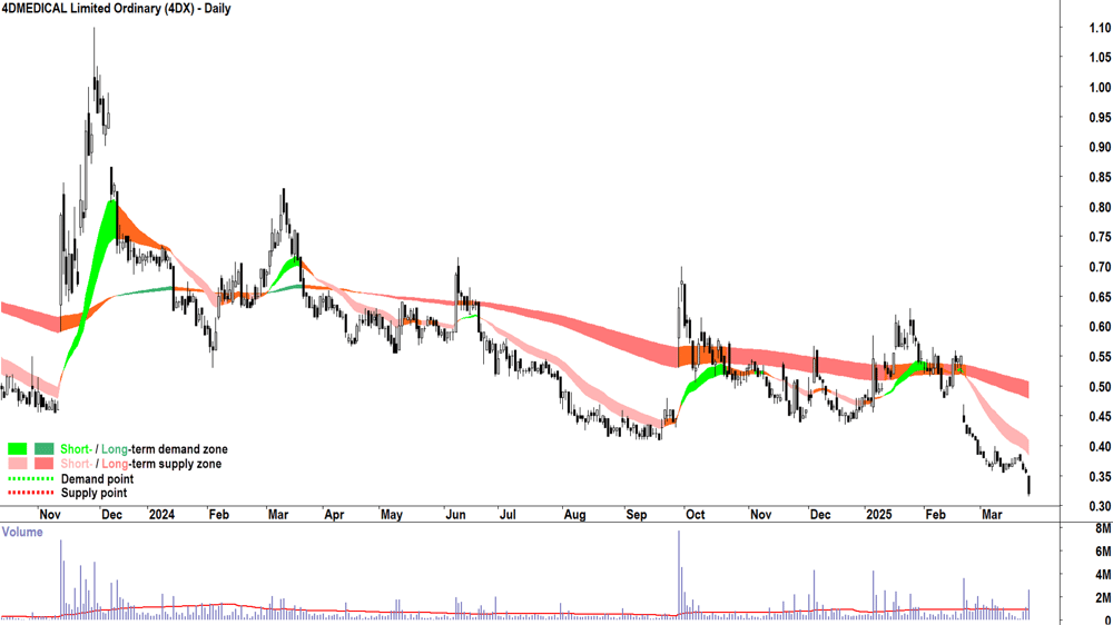 4DMEDICAL (ASX-4DX) daily chart 26 March 2025