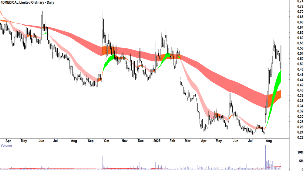 4DMEDICAL (ASX-4DX) daily chart 29 August 2025