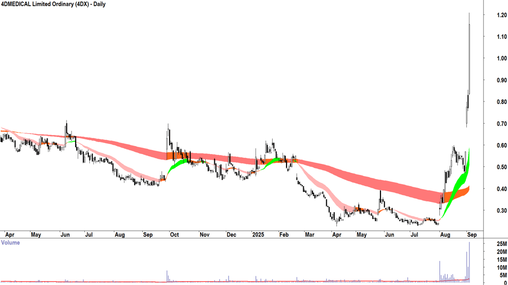 4DMEDICAL (ASX-4DX) daily chart 3 September 2025