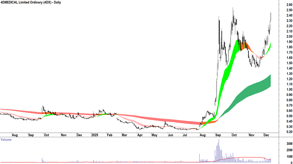4DMEDICAL (ASX-4DX) Daily chart 15 December 2025