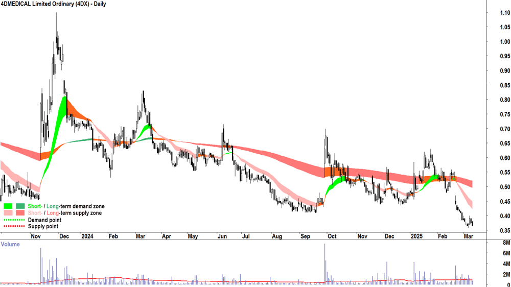 4DMEDICAL (ASX-4DX) daily chart 12 March 2025
