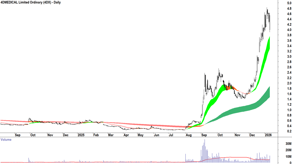 4DMEDICAL (ASX-4DX) Daily chart 15 January 2026