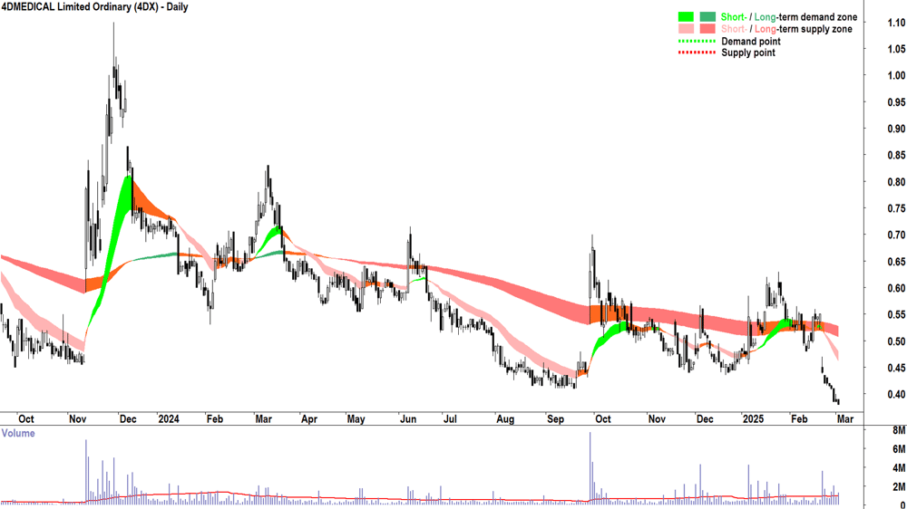 4DMEDICAL (ASX-4DX) daily chart 4 March 2025