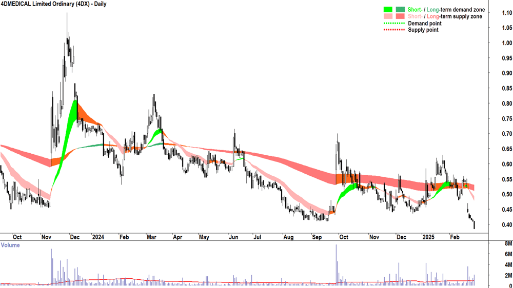 4DMEDICAL (ASX-4DX) daily chart 28 February 2025