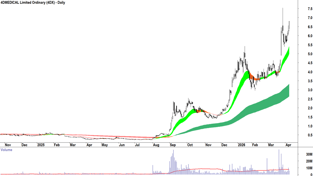 4DMEDICAL (ASX-4DX) Daily chart 10 April 2026