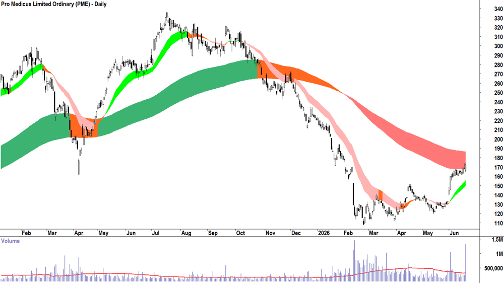 Pro Medicus (ASX-PME) Daily chart 19 June 2026