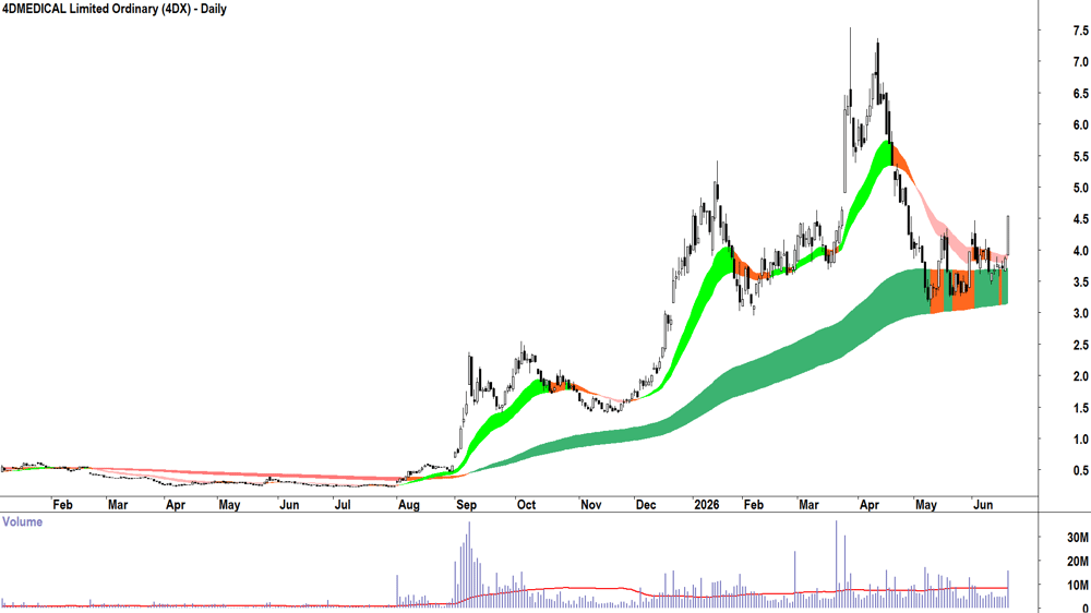 4DMEDICAL (ASX-4DX) Daily chart 19 June 2026