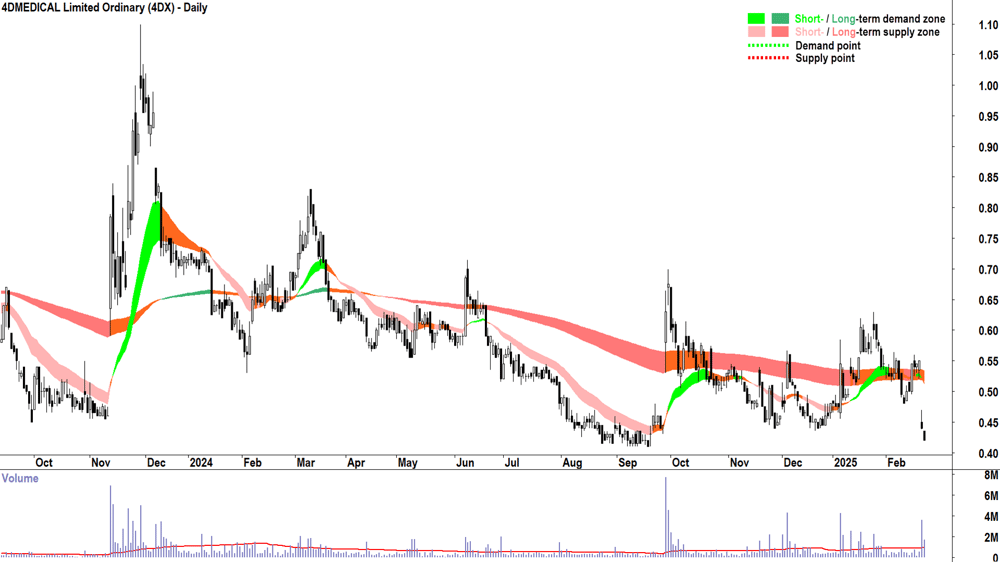 4DMEDICAL (ASX-4DX) daily chart 24 February 2025
