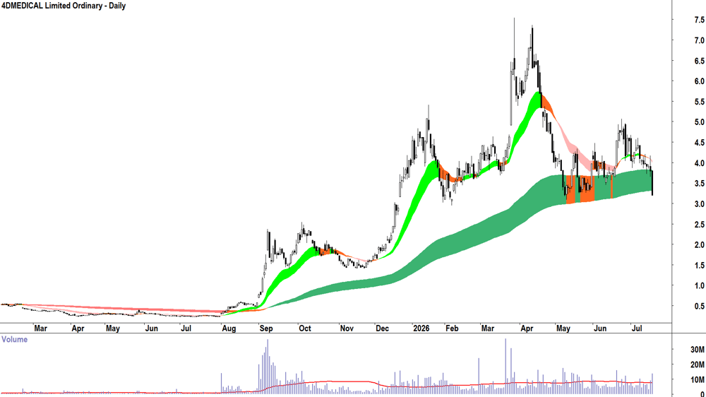 4DMEDICAL (ASX-4DX) Daily chart 17 July 2026