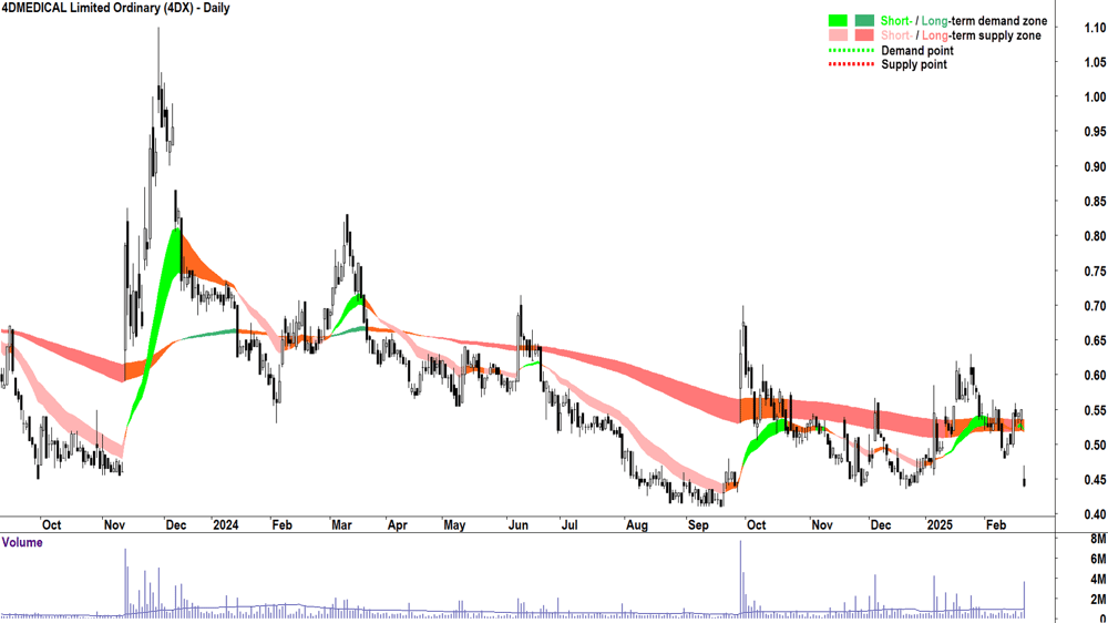4DMEDICAL (ASX-4DX) daily chart 21 February 2025