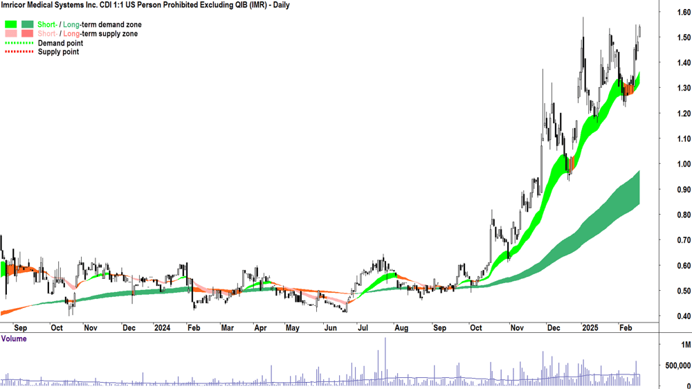 Imricor Medical Systems (ASX-IMR) daily chart 19 February 2025