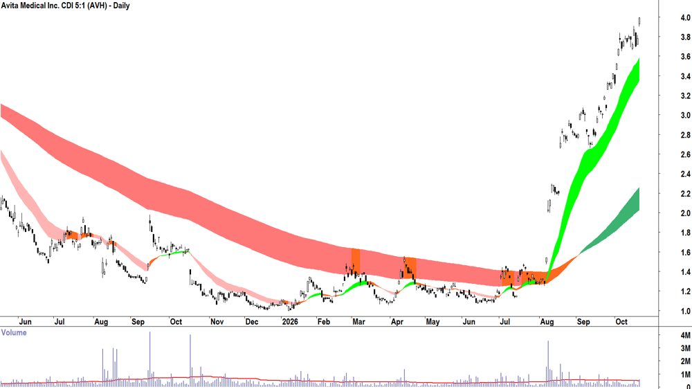 Avita Medical (ASX-AVH) Daily chart 21 October 2026