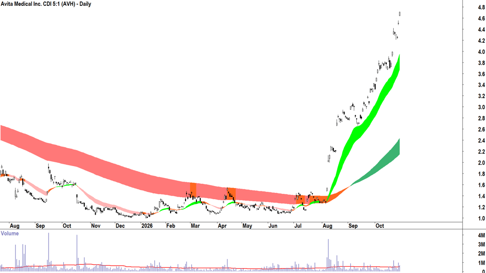 Avita Medical (ASX-AVH) Daily chart 29