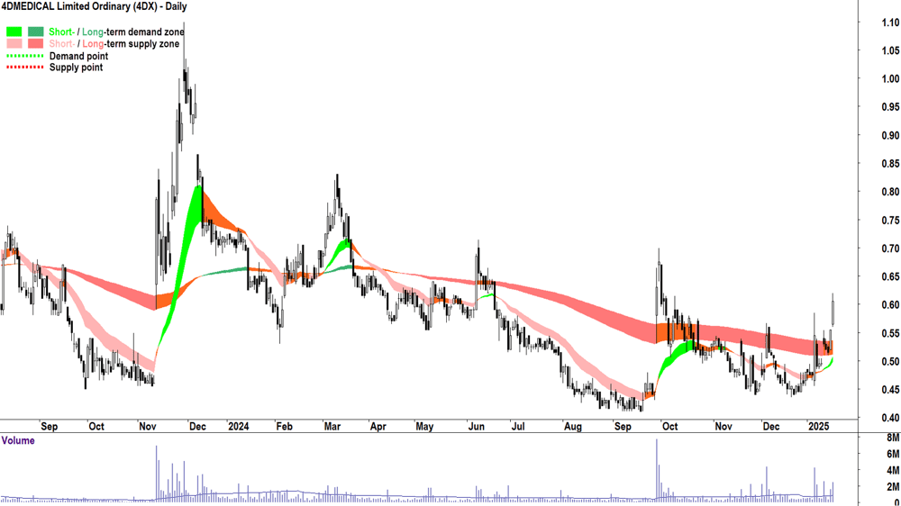 4DMEDICAL (ASX-4DX) chart 17 January 2025