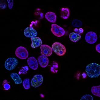 Biotech Arovella to receive Europe patent for its iNKT cell therapy platform